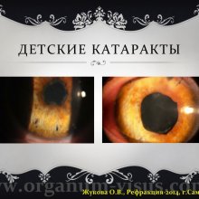 Жукова О.В. Доклад на конференции Рефракция-2014, посвященной 50-летию Первого в практическом здравоохранении России детского офтальмологического отделения (Самарская областная офтальмологическая больница им. Т.И.Ерошевского), 28-30 ноября, г. Самара, Россия.   Информационный партнер портал Орган зрения www.organum-visus.com