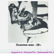 Куликов А.Н., Рейтузов В.А., Трояновский Р.Л. Организация офтальмологической помощи раненым во время Советско-Финляндской войны. Доклад на пленарном заседание СПбНМОО 27 октября 2015г. Информационный партнер портал Орган зрения www.organum-visus.com