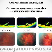 Рябцева А.А. Московской областной офтальмологии 145 лет. Доклад на XV Всероссийской Школе офтальмолога (ВШО-2015, Снегири). Информационный партнер портал Орган зрения www.organum-visus.com