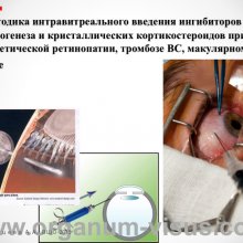 Рябцева А.А. Московской областной офтальмологии 145 лет. Доклад на XV Всероссийской Школе офтальмолога (ВШО-2015, Снегири). Информационный партнер портал Орган зрения www.organum-visus.com