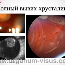 Рябцева А.А. Московской областной офтальмологии 145 лет. Доклад на XV Всероссийской Школе офтальмолога (ВШО-2015, Снегири). Информационный партнер портал Орган зрения www.organum-visus.com
