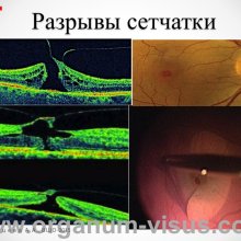 Рябцева А.А. Московской областной офтальмологии 145 лет. Доклад на XV Всероссийской Школе офтальмолога (ВШО-2015, Снегири). Информационный партнер портал Орган зрения www.organum-visus.com